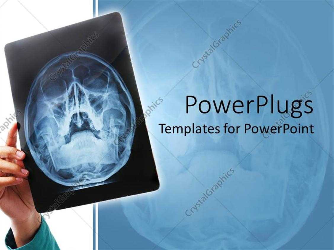 Powerpoint Template: Hand Holding Up X Ray Scan Of Human Throughout Radiology Powerpoint Template
